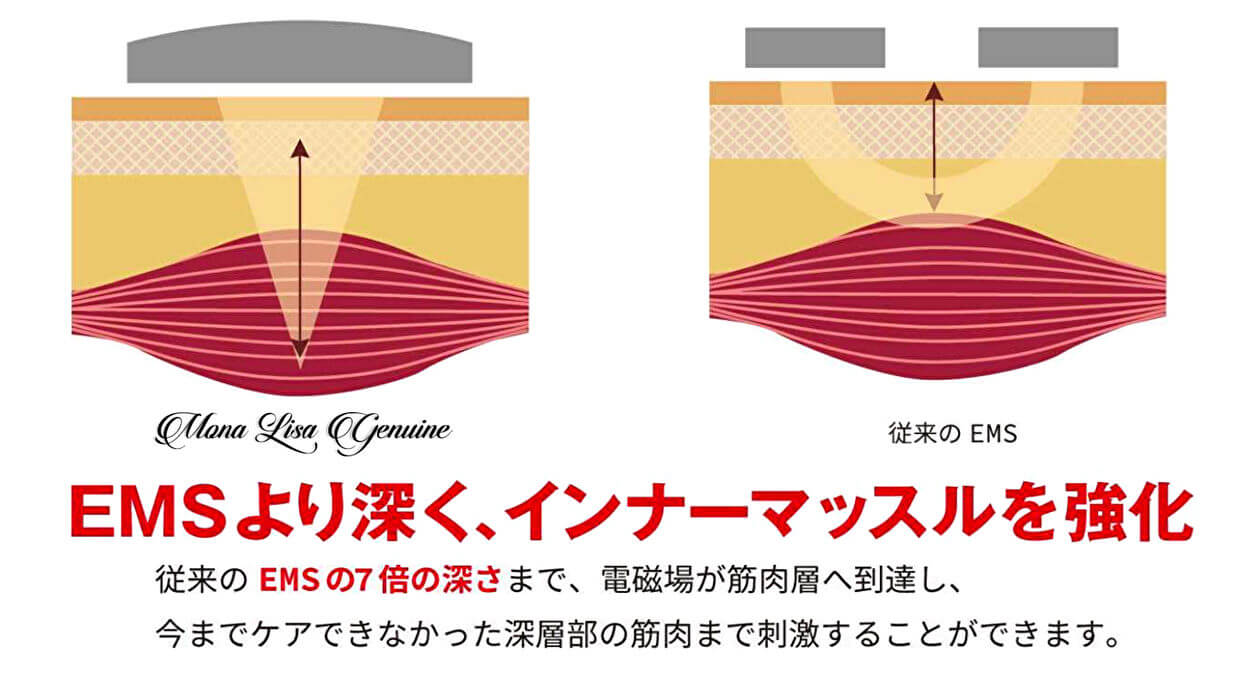 お買物マラソン最大1000円OFFクーポンあり 超音波美容機器 モナリザ